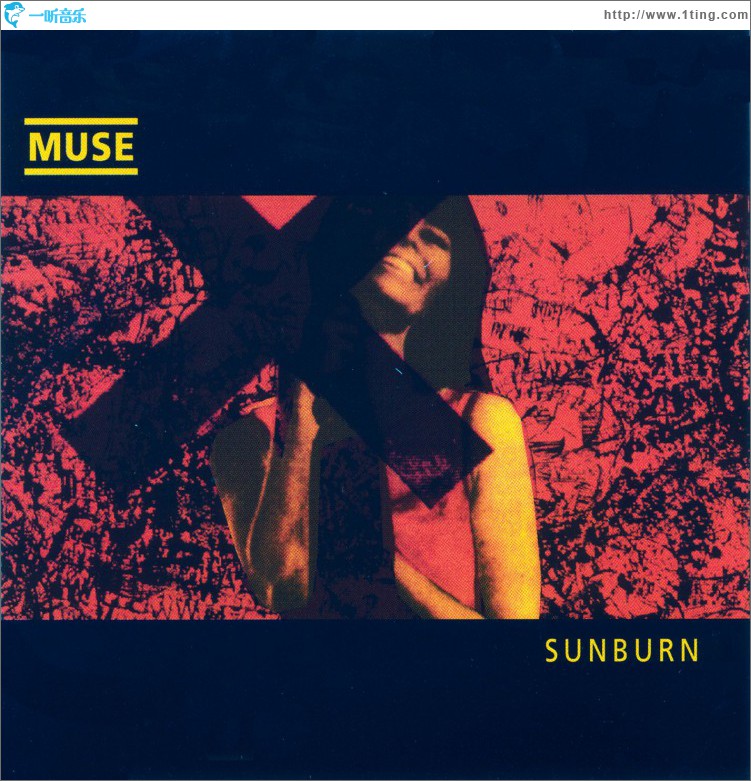 Sunburn