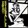 Xray Eyeballs Sundae 试听
