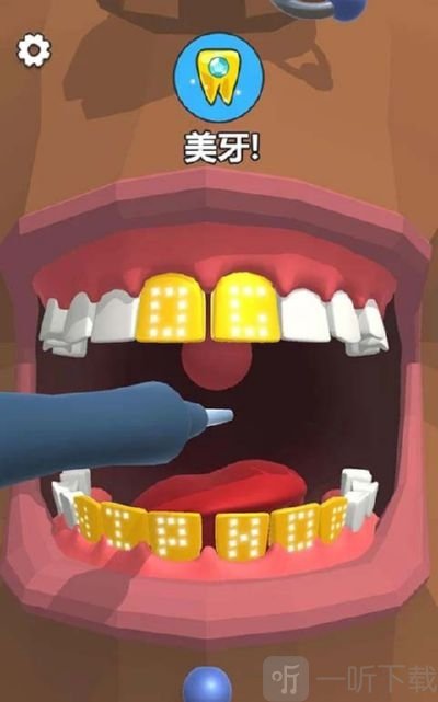 洗牙