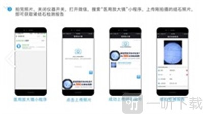 医用放大镜