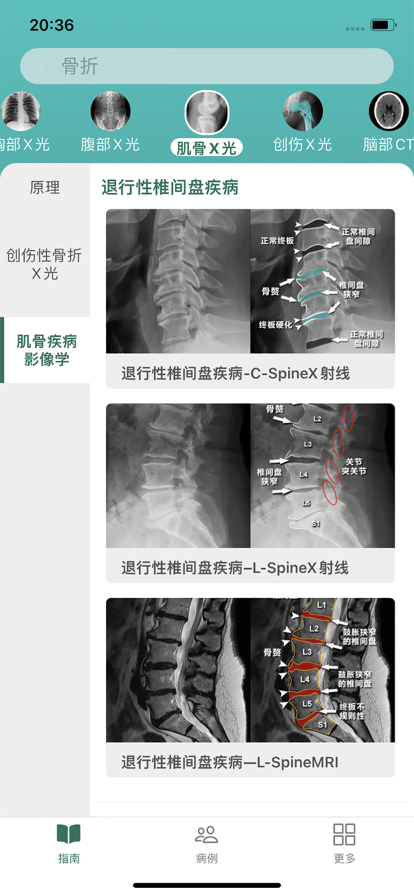 影像診斷指南