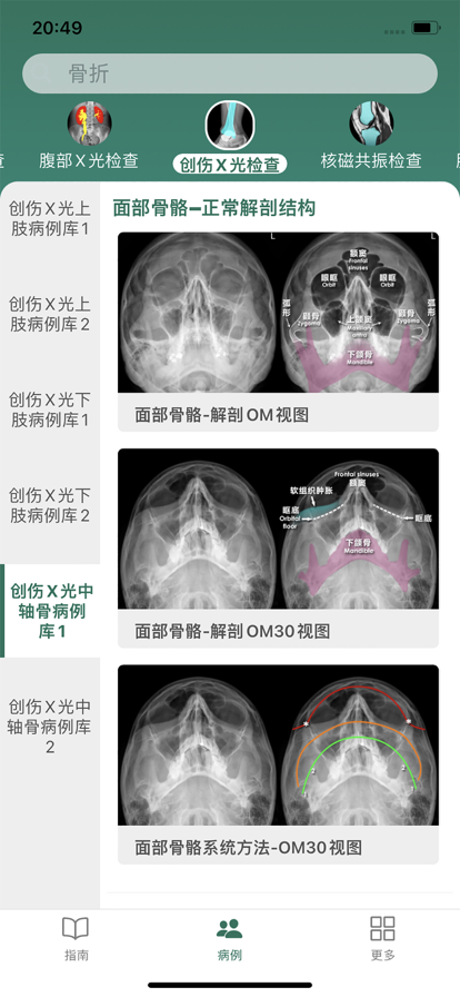 影像診斷指南