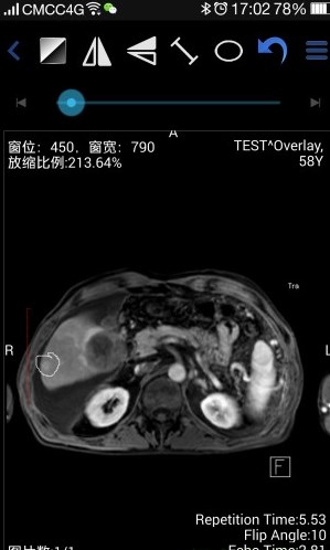 医影