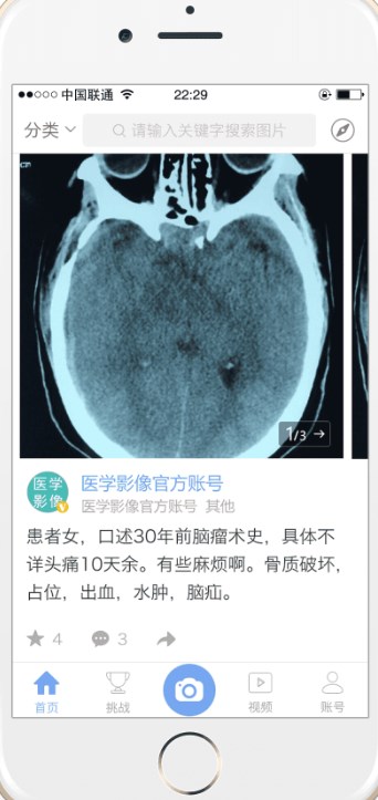 医影