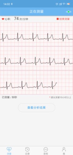 数维康心电