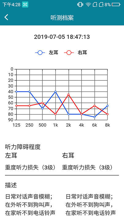 億耳助聽
