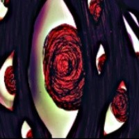 脑叶公司汉化版蜘蛛囊异想体